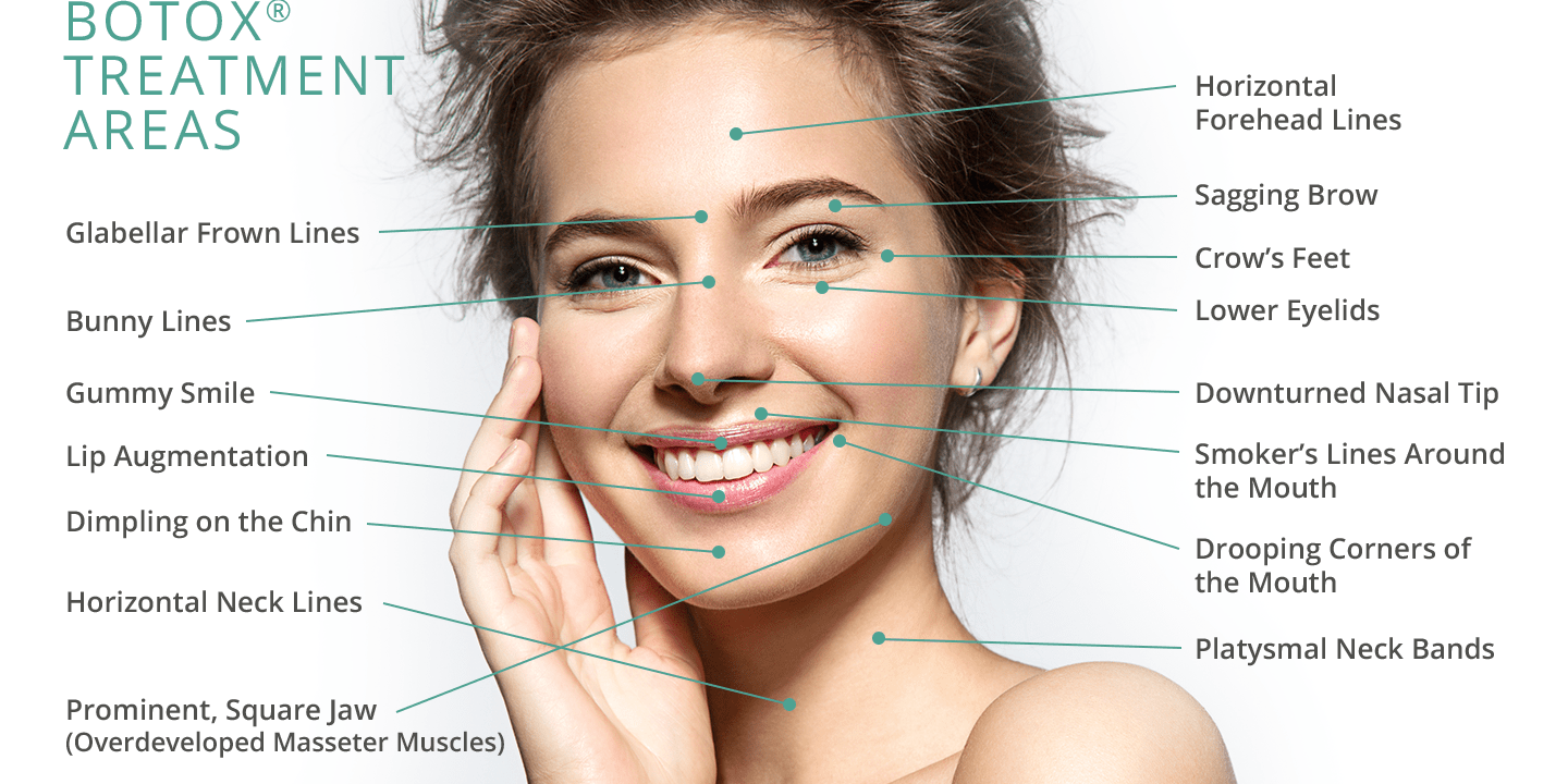 Schnelle ambulante Botox Behandlung
