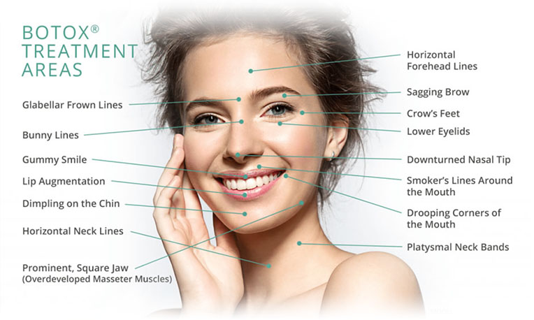 Individuell anpassbare Botox Behandlung