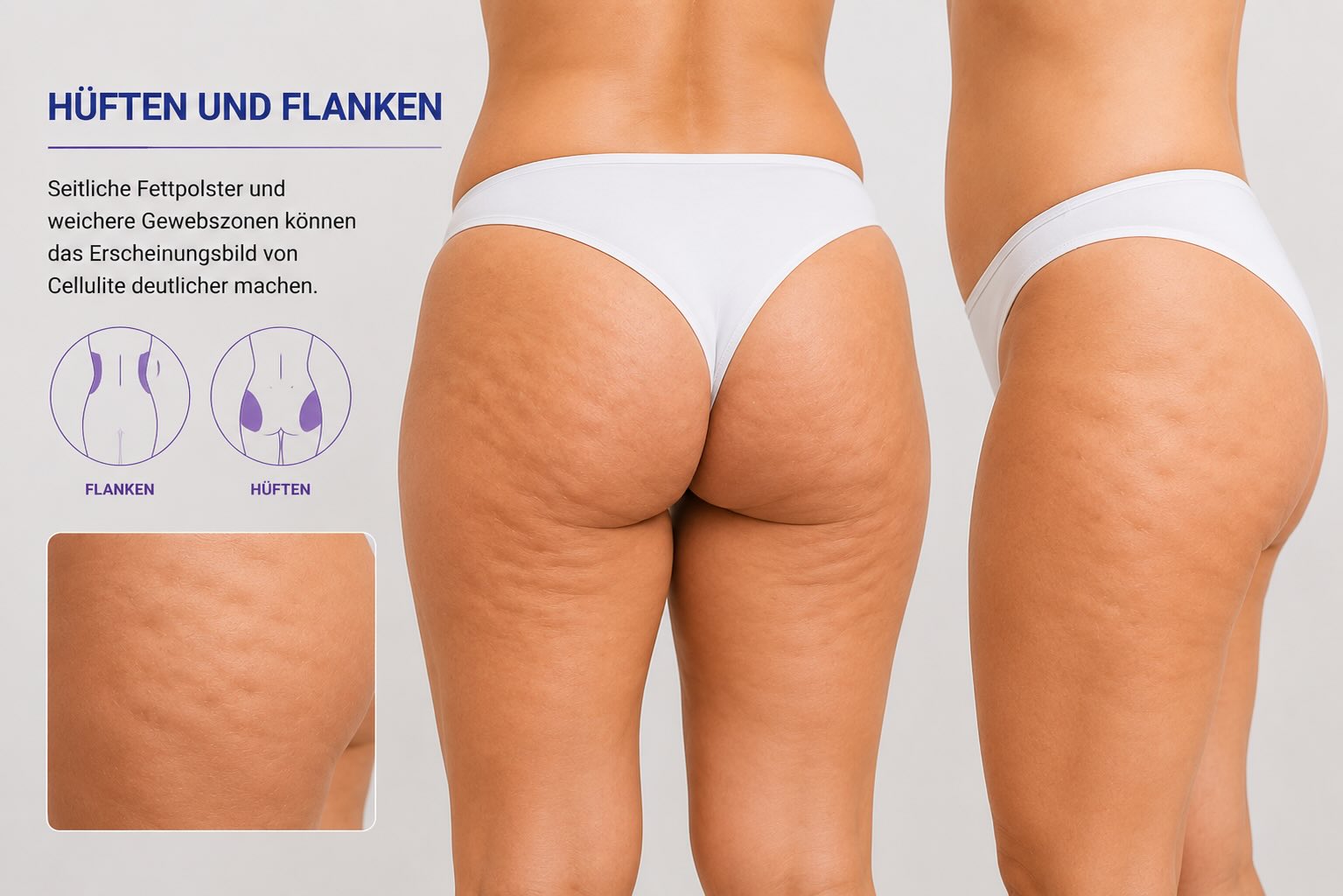 Flanken und Taille als Zielregion für T-Shape 2