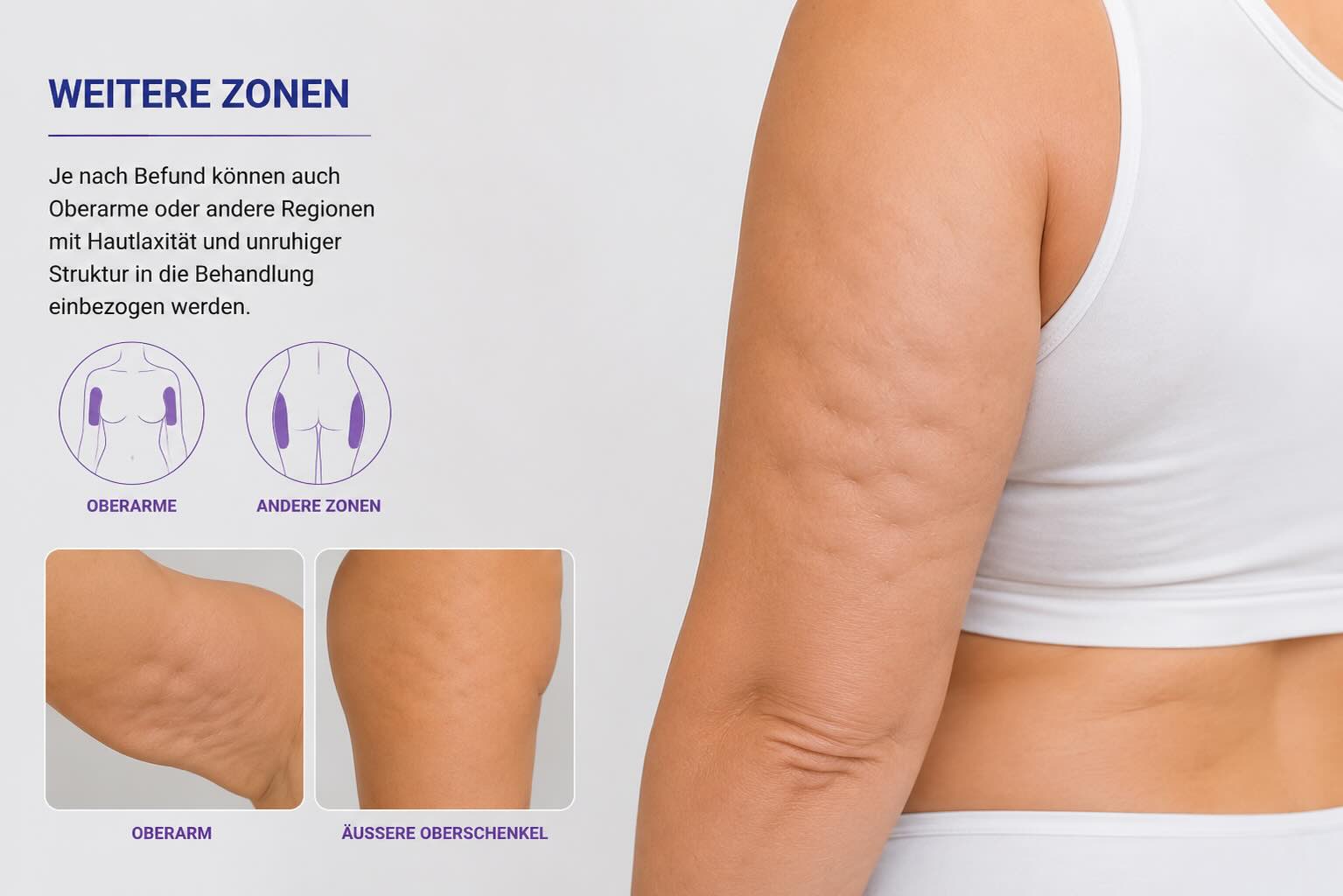 Oberarme als Zielregion für T-Shape 2