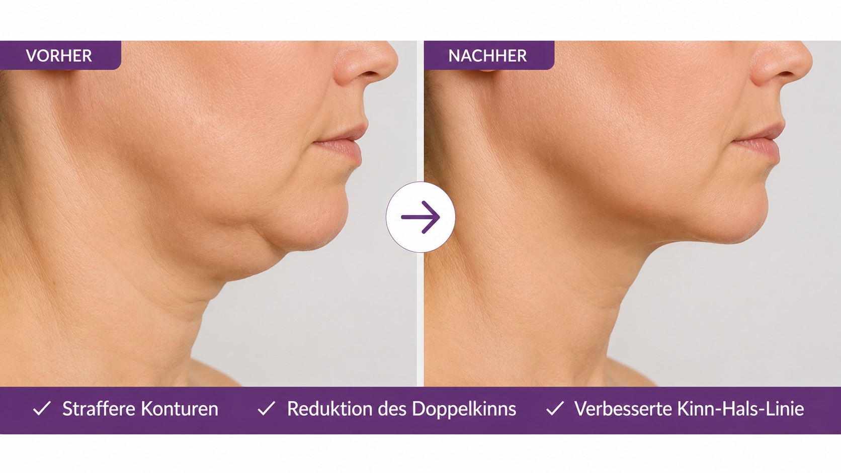 Individuelle Profound Matrix Behandlungskonzepte