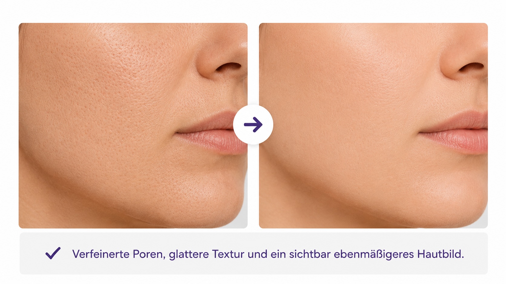 Hauttextur und Porenbild mit Profound Matrix