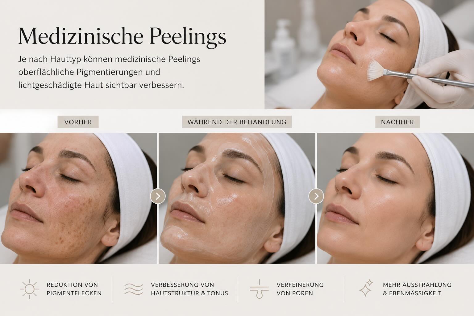 Medizinische Peelings bei Altersflecken und lichtgeschaedigter Haut