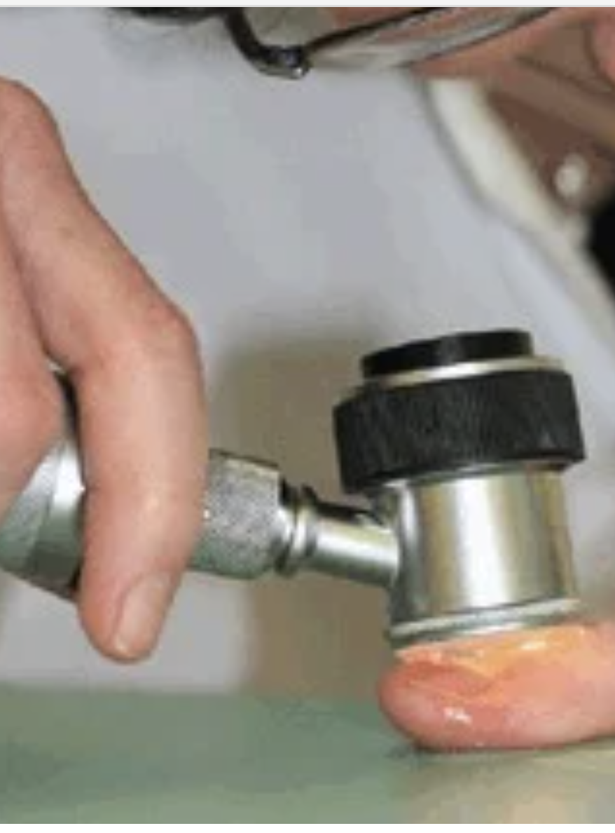 Dermatoskopie hoher Aufloesung