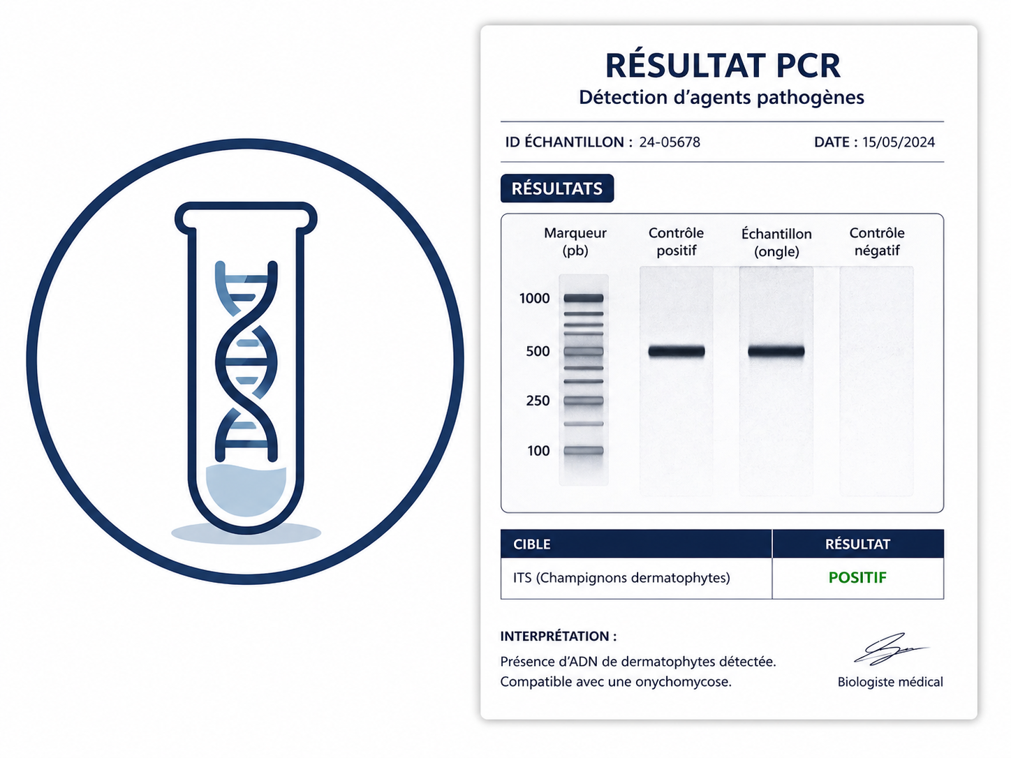 PCR Analyse bei Nagelerkrankungen