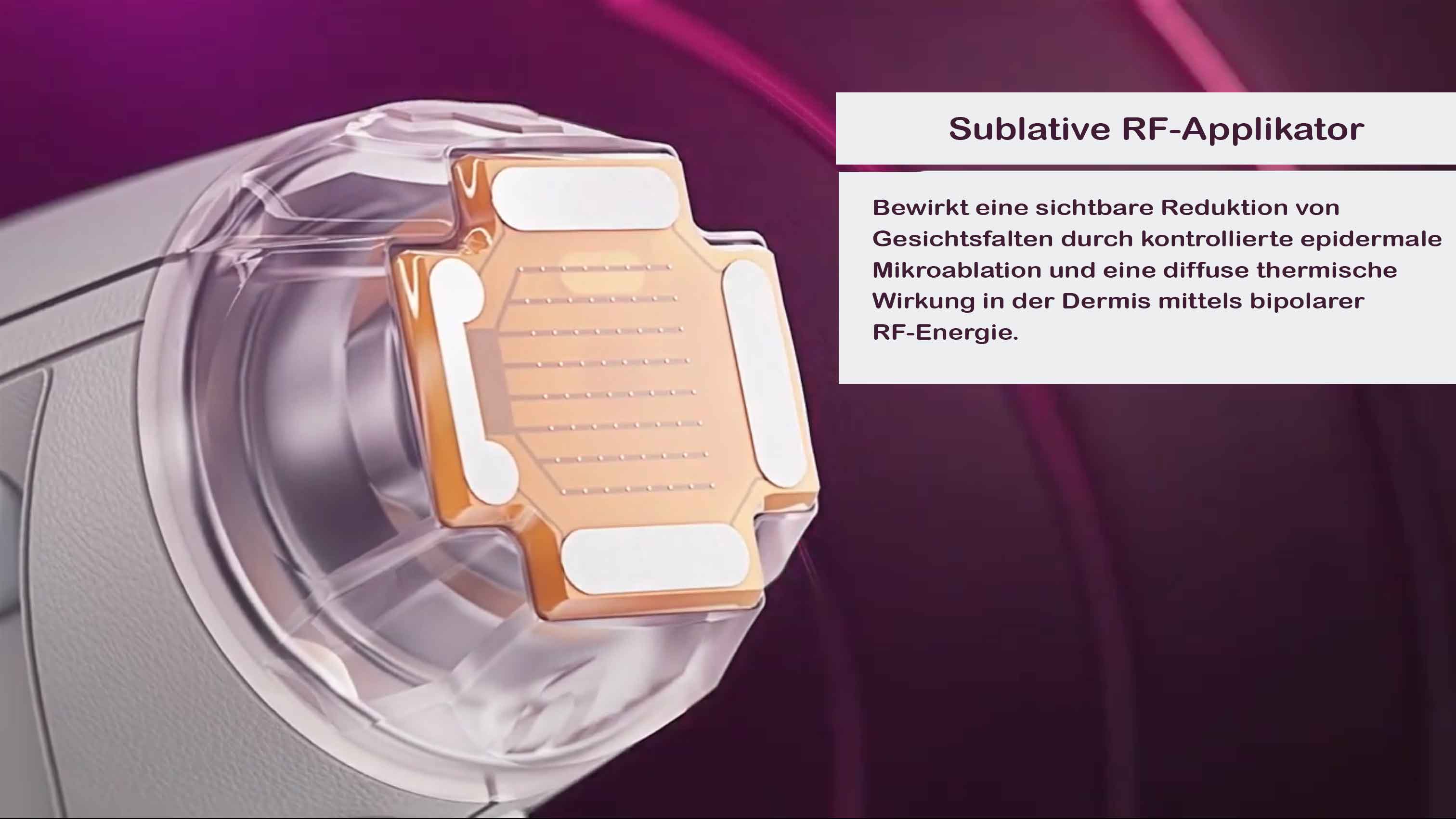 Sublative RF Beispielbild