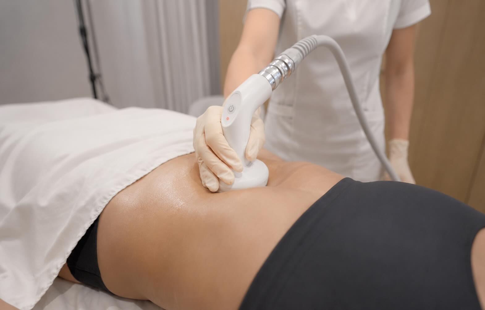 T-Shape und Radiofrequenz am Bauch