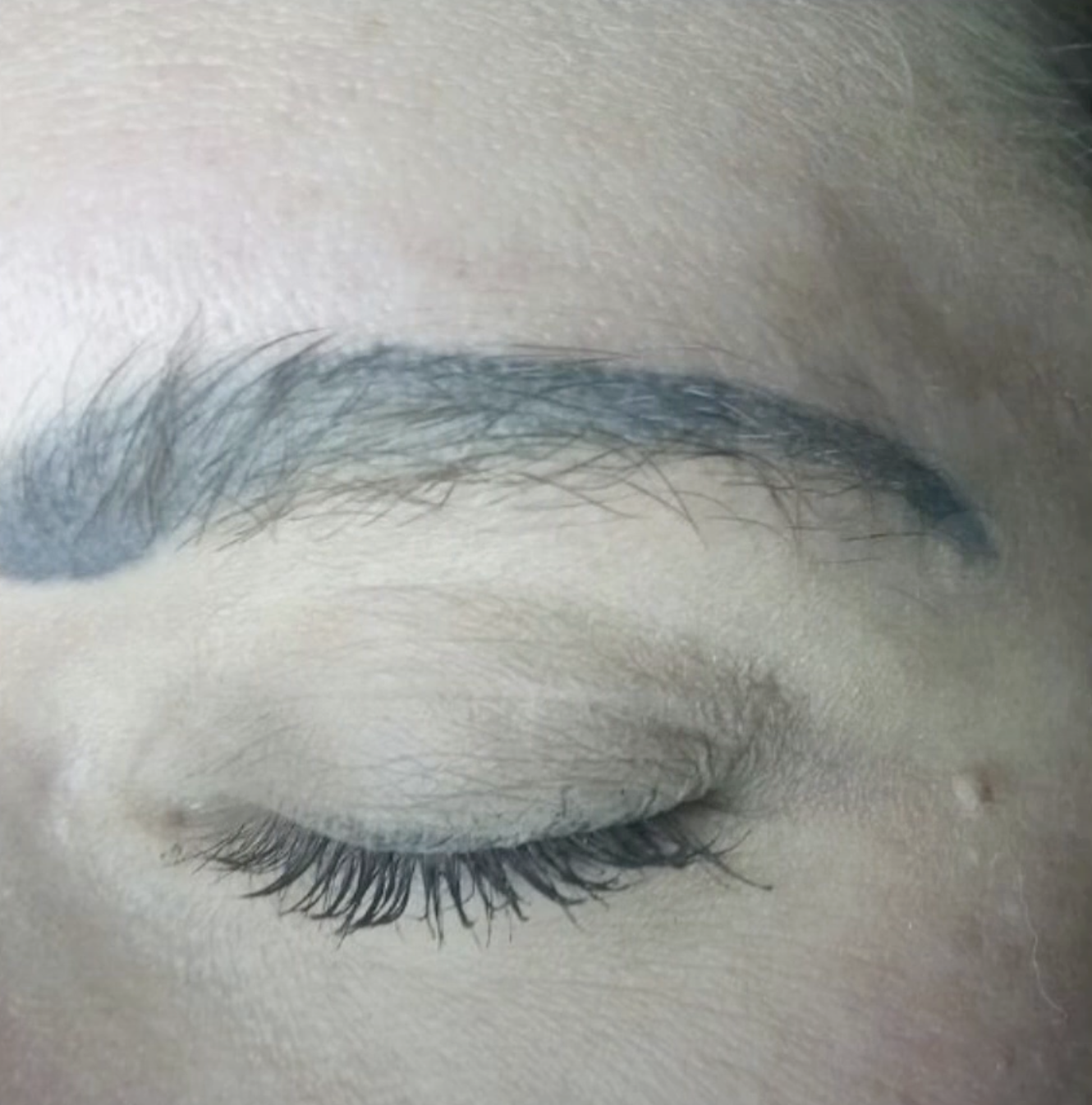 Nach Permanent Make-up Entfernung Augenbraue